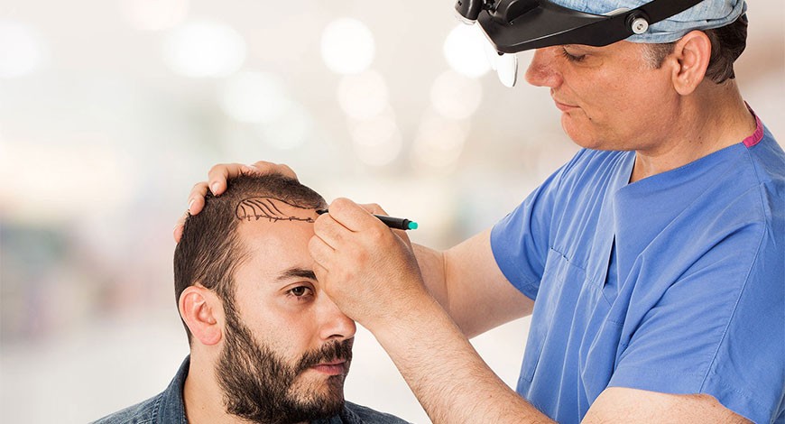 Greffe cheveux Turquie - Esthetic Clinic Turkey